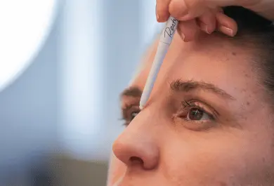 Rinoplastia 2