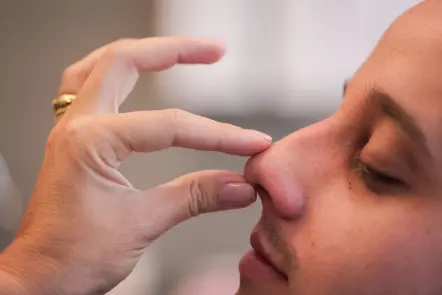 Rino - Cirurgia Facial