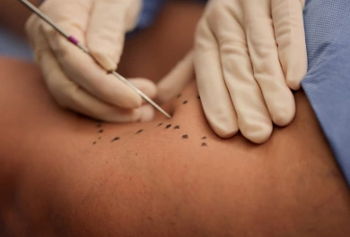 GALERIA 1 - Cirurgia Vascular