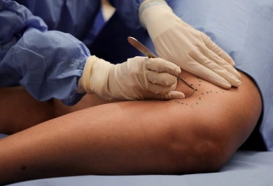 GALERIA 2 - Cirurgia Vascular