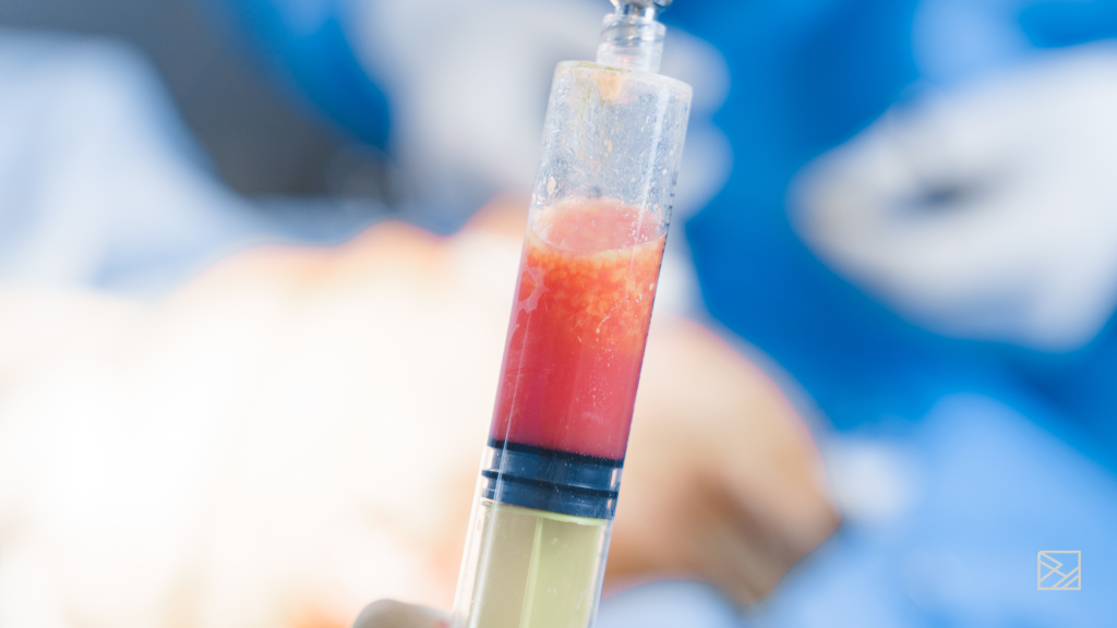 nanofat-microfat-terapia regenerativa